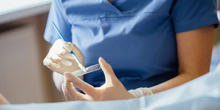 Personas con útero podrán hacerse PAP sin turno y gratuitamente ¿Dónde?